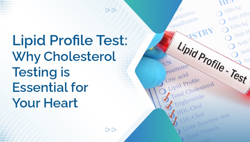 Lipid Profile Test- Why Cholesterol Testing Is Essential for Your Heart